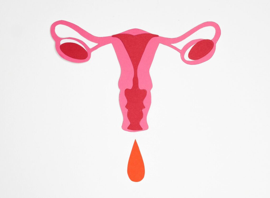 Educational diagram of uterus and ovaries used in menopause care information in Limassok